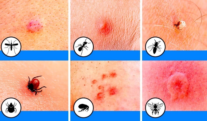 Insect bite remedy for itching and swelling. Reviews