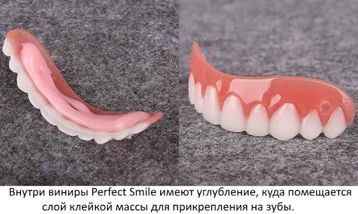Perfect Smile Veneers. Reviews are real, instructions on how to install