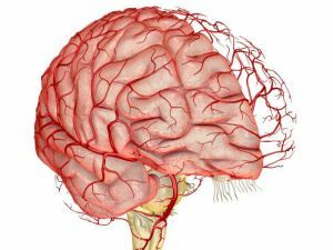 Ateroskleróza mozková