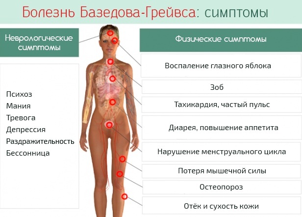 Hajus mürgine struuma. Ravi, sümptomid, kliinilised juhised, diagnoos