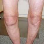 kontur lutut