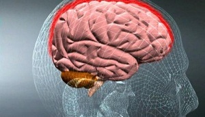 leziuni ale creierului