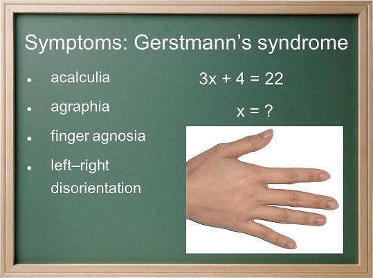 Symptômes du syndrome de Gerstmann