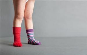 Alt bacak yetişkinlerde ve çocuklarda Varus deformitesi