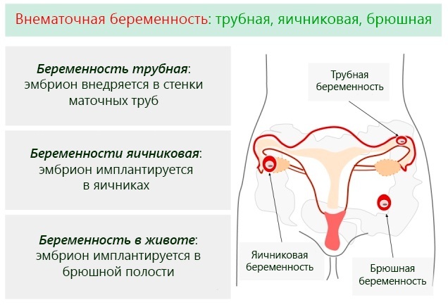 Bioquímica do soro materno no trimestre 1-2-3. Decodificação