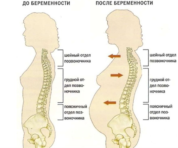 Repna kost boli med nosečnostjo v 1-2-3 trimesečju. Razlogi, kaj storiti