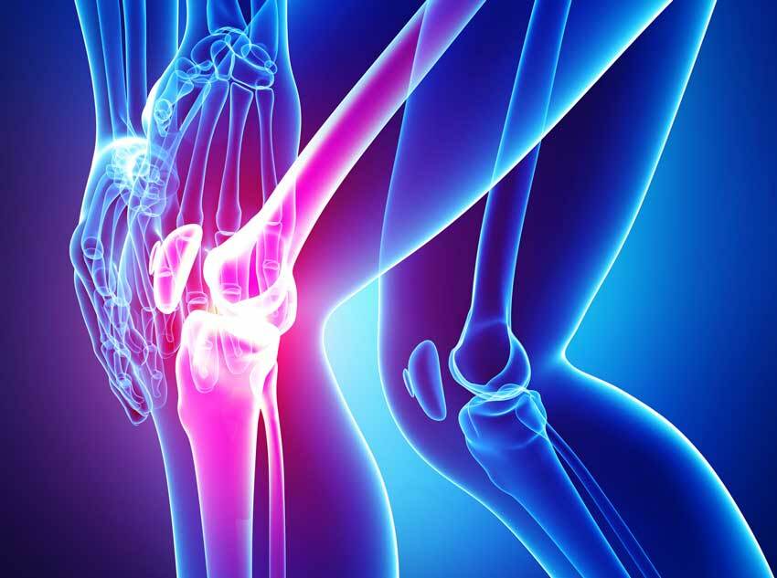 Forskyder arthritis af knæleddet fra artrose