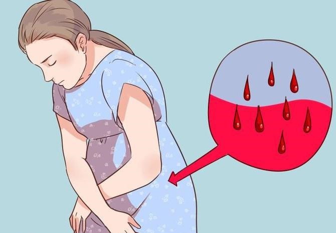 Drugs to stop the blood with heavy menstrual period. Folk remedies