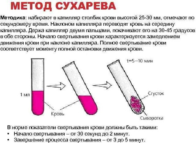 La coagulabilité du sang selon Sukharev. Normes, temps