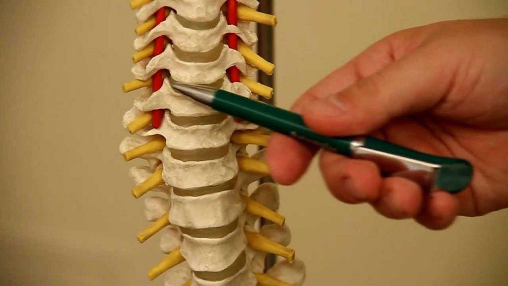 Klasična ukrivljenost hrbtenice se imenuje - definicija in metode zdravljenja!