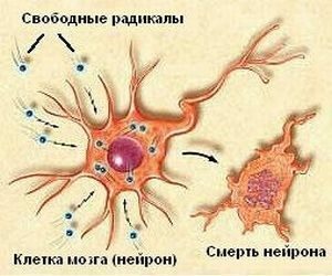 destroyed neuron