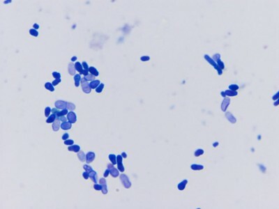 Malassezia - grybelis