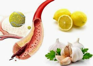 cleaning of blood vessels with garlic