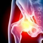Inflammation af hofteleddet