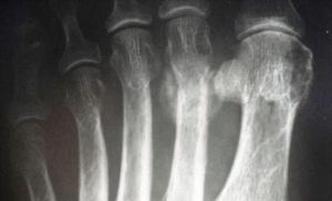 Parada de rayos X