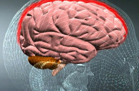 דלקת קרום המוח אצל מבוגרים: תסמינים וסימנים, שיטות טיפול