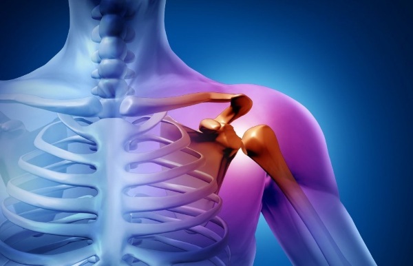 Periarthritis of shoulder joint. Treatment, symptoms, exercises, pills