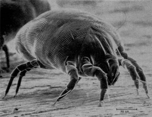 Dust mites. Photo under a microscope, how to get rid