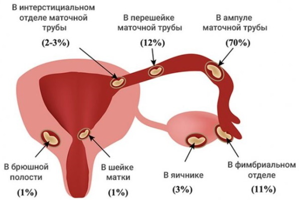Halebenet gjør vondt i svangerskapet i 1-2-3 trimester. Årsaker til hva du skal gjøre