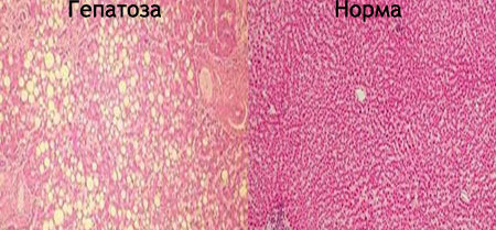 Kepenys - riebalinė hepatoszė: simptomai ir gydymas, mityba