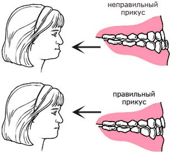 Examen de la cavidad bucal y la faringe en niños, adultos. Algoritmo de manipulación