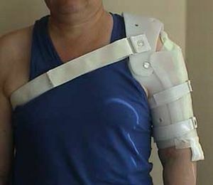 orthosis on the shoulder and forearm