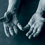 Artritída kĺbov prstov na rukách