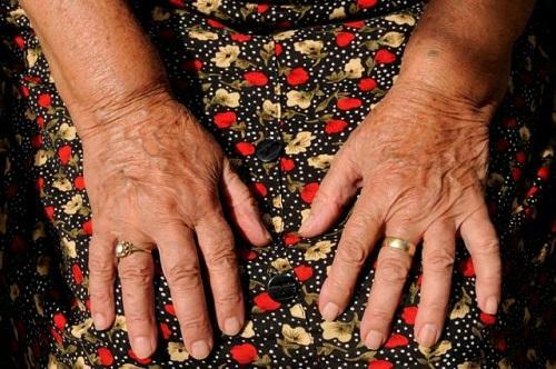 Causes of rheumatoid arthritis