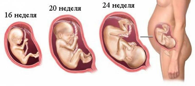 Povećanje veličine fetusa može potaknuti napad abdominalne boli