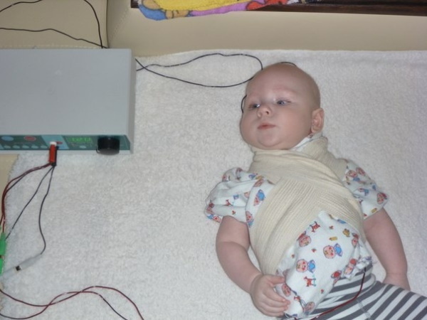 Electrophoresis for babies on the neck. Reviews