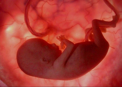 Humant embryo