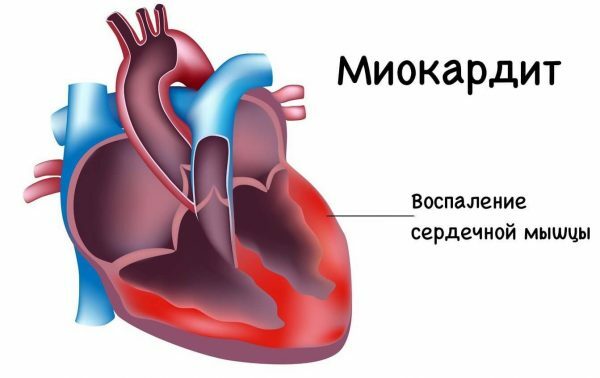 Medicinske egenskaber af Baikal kalot og kontraindikationer rodekstrakt, urtetinktur