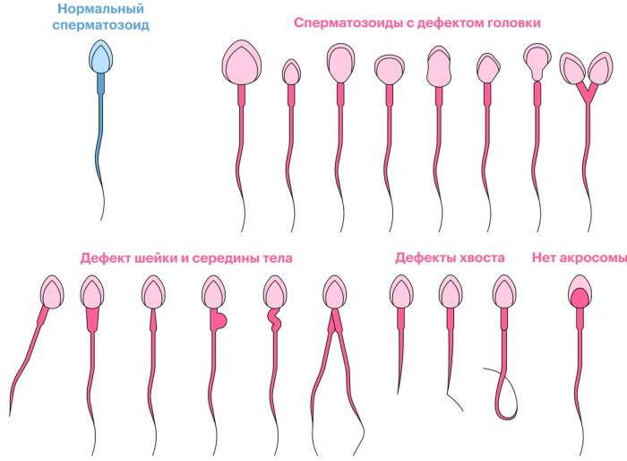 Preparations for improving sperm (spermogram). Pills