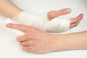 Oireet, hoito ja elpyminen käden murtuman jälkeen