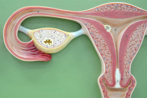 Myoma van de baarmoeder - wat is het?
