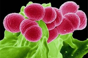 Parece Staphylococcus aureus