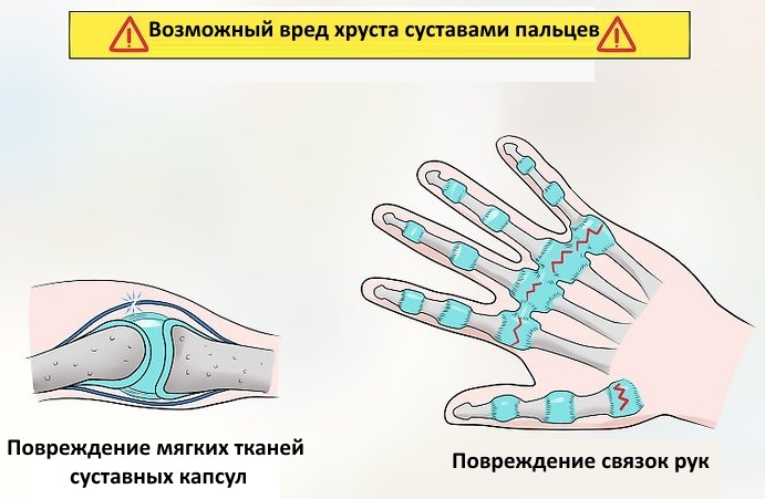 Is it harmful to crunch your fingers on your hands. Scientific explanation