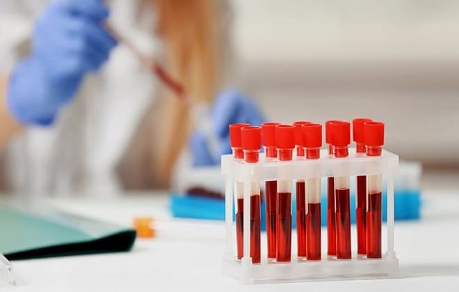 Pobieranie próbek krwi żylnej w biurze