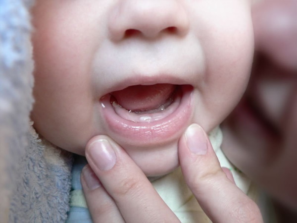Hvordan tannkjøttet hovner opp når det kommer tenner hos barn