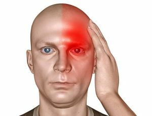 migraine met aura