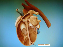 Penyakit pembuluh darah dan jantung dalam figur dan fakta