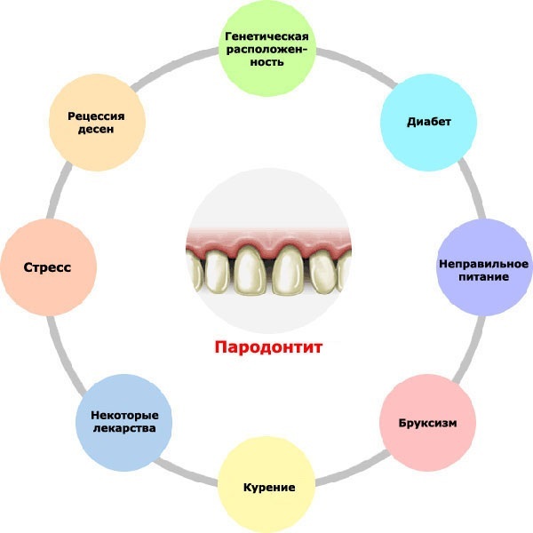 Periodontitis. Home treatment with folk remedies, decoctions, ointments, antibiotics. Etiology, pathogenesis, causes