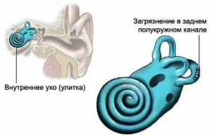 Auditory snail