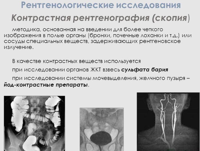 X-ray of the knee joint in two projections. Price, which shows it is normal, how it is done, photo