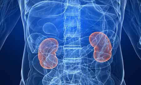 Nephroptosis of the right kidney