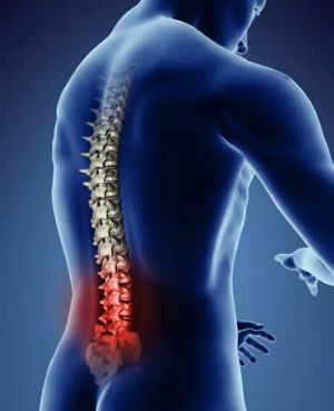 pain syndrome in the lower back