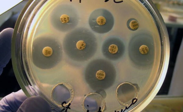 Hoe urine te verzamelen op een tankcultuur voor flora tijdens de zwangerschap?