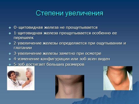The degree of enlargement of the thyroid gland