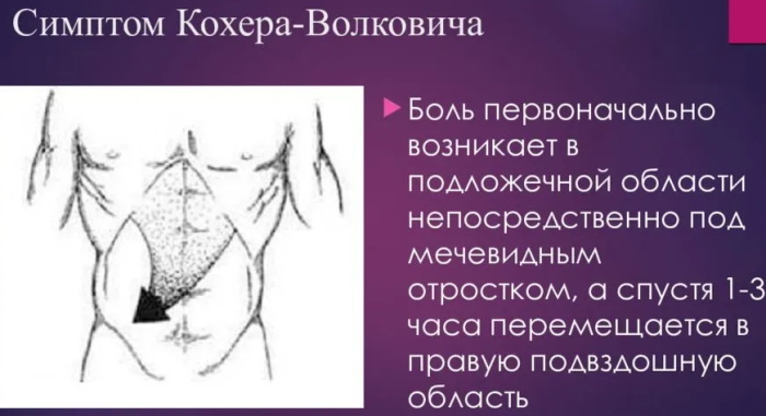 Kocher's symptom with appendicitis. This is what, the mechanism, why there is