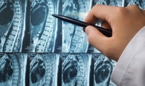 Radiografía de la columna vertebral